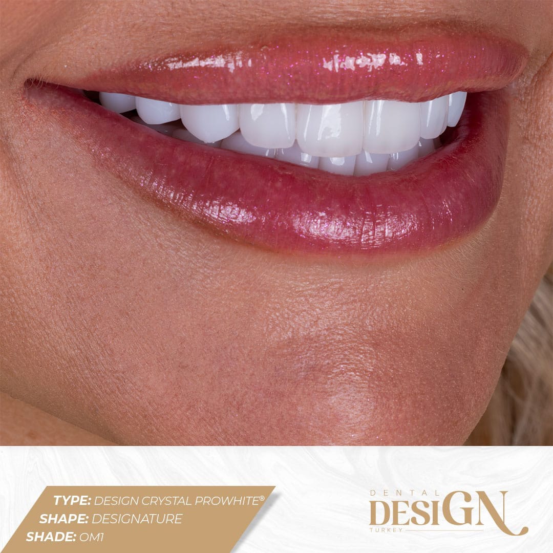 Dental Design Turkey Antalya | Best Dental Implants 15 cyrstal